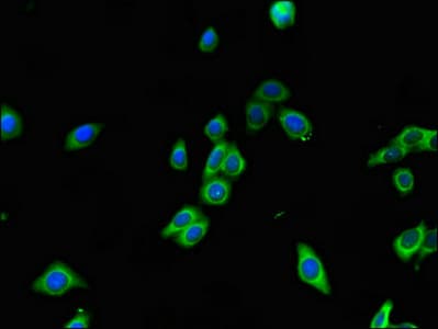 RAB7A / RAB7 Antibody