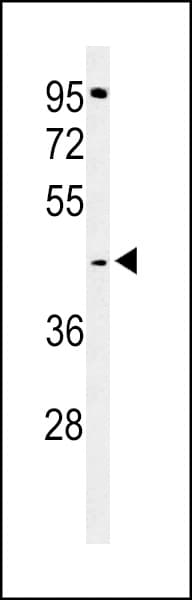 TECR / TER Antibody (aa268-295)