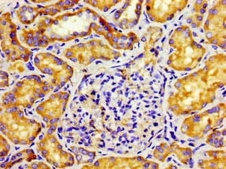 TUBD1 / Tubulin Delta Antibody