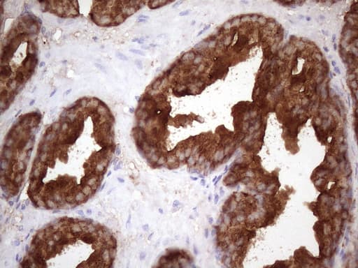 KLK3 / PSA Antibody (aa25-261, clone OTI1F7)