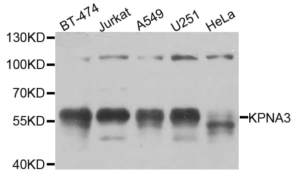 KPNA3 / Importin Alpha 4 Antibody