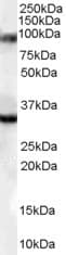 IHC-plus™ LDB3 / ZASP Antibody (aa319-330)