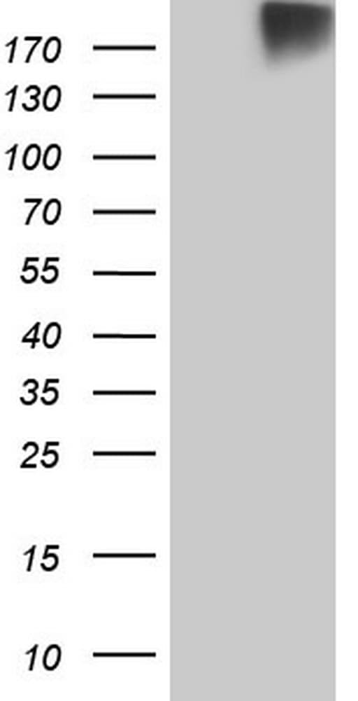 ROS1 / ROS Antibody (aa2126-2347, clone OTI7E4)