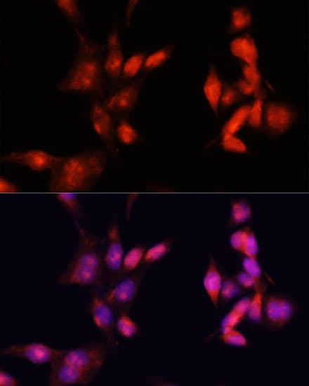IRAK1 / IRAK Antibody