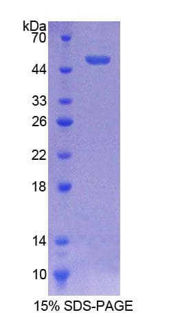 Human ATF3 Protein (Recombinant His-GST)
