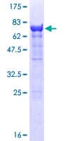 Human PSMC3 Protein (Recombinant GST)