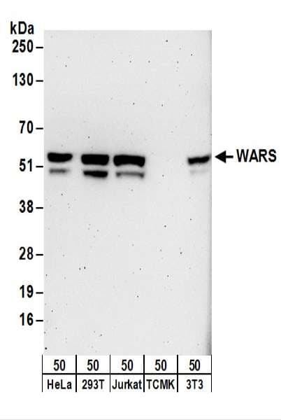 WARS Antibody (aa421-471)