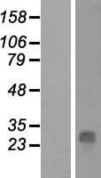 Human QDPR / DHPR Protein (Over-Expression Lysate Myc-DDK (Flag))
