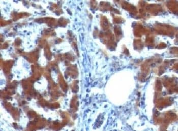 RBP / Retinol Binding Protein Antibody (clone RLBD1)