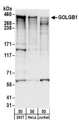 IHC-plus™ GRIP1 Antibody (aa1026-1076)