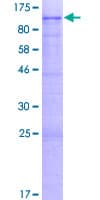 Human CNOT10 Protein (Recombinant GST)