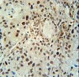 Polyclonal Rabbit anti-Human ABHD14B Antibody (aa150-179, IHC, WB)