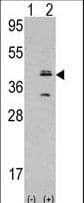 Polyclonal Rabbit anti-Human MVK Antibody (aa17-47, WB)