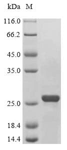 Mouse NIP3 / BNIP3 Protein (Recombinant 6His, N-terminus)