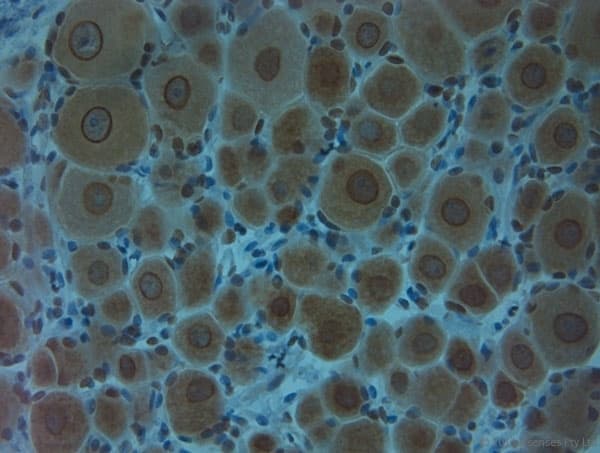 Polyclonal Rabbit anti-Human CLVS1 Antibody (aa300-354, IHC, WB)