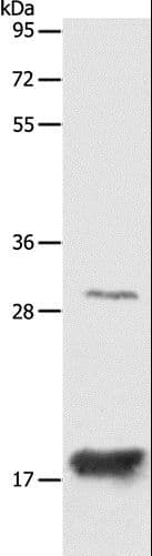 Polyclonal Rabbit anti-Human AGR2 Antibody (IHC, WB)