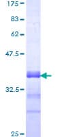 Human PBX3 Protein (Recombinant GST, N-terminus)