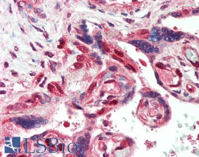 LIN28B Antibody (aa200-250)