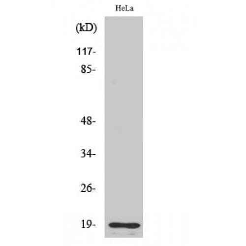 Polyclonal Rabbit anti-Human F2 / Prothrombin / Thrombin Antibody (250-330 aa, Internal, WB)