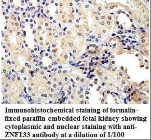 Polyclonal Rabbit anti-Human ZNF133 Antibody (aa388-635, IHC, WB)