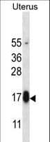 Polyclonal Rabbit anti-Human GPHB5 Antibody (aa62-91, IHC, WB)