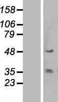 KRT13 / CK13 / Cytokeratin 13 Protein (Over-Expression Lysate Myc-DDK (Flag))