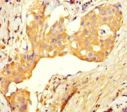 UBE2T / HSPC150 Antibody