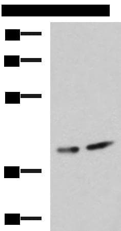 PROKR2/Prokineticin Receptor 2 Antibody
