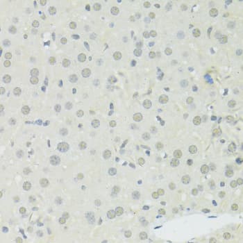 BRCA1 Antibody