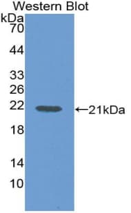 IL36RN / IL1F5 Antibody (aa1-156)