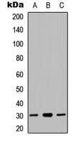 Polyclonal Rabbit anti-Human NDUFS3 Antibody (Internal, WB)