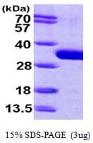 Human SBDS Protein (Recombinant His)