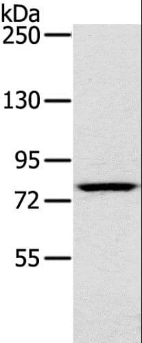 RPS6KA1 / RSK1 Antibody