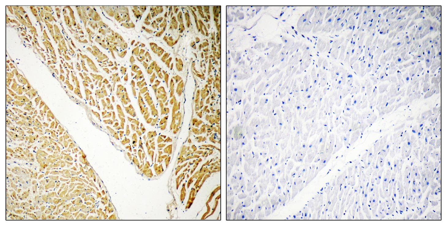 Polyclonal Rabbit anti-Human CABP7 Antibody (IHC, WB)
