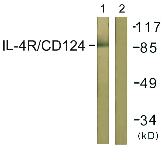 IL4R / CD124 Antibody (aa463-512)