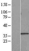 STARD7 Protein (Over-Expression Lysate Myc-DDK (Flag))