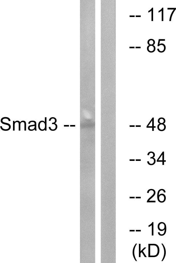 Polyclonal Rabbit anti-Human SMAD3 Antibody (p204, IHC, WB)