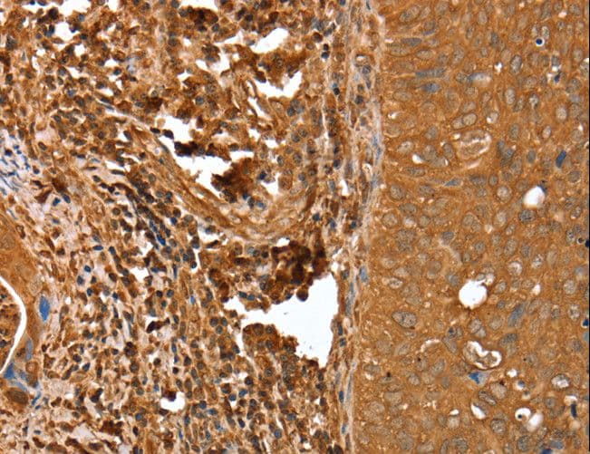 Polyclonal Rabbit anti-Human CNN3 Antibody (IHC, WB)