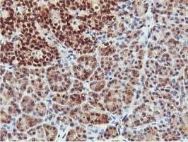 COASY Antibody (clone OTI3B3)