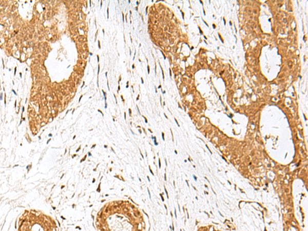 Polyclonal Rabbit anti-Human IPO11 / Importin 11 Antibody (IHC, WB)