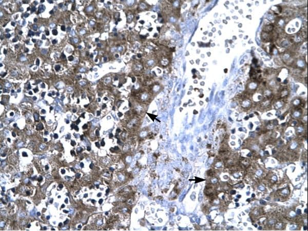MMP19 Antibody (aa349-398)