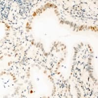 GABPB1 Antibody