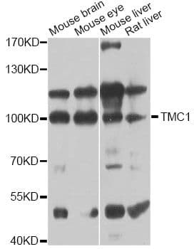 Polyclonal Rabbit anti-Human TMC1 Antibody (WB)