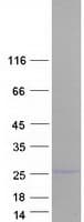 Human Vps60 / CHMP5 Protein (Recombinant Myc-DDK (Flag))