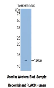 PLAC9 Antibody (aa23-97)