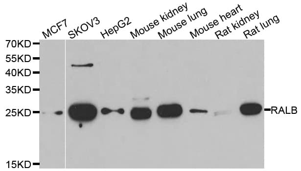 RALB Antibody