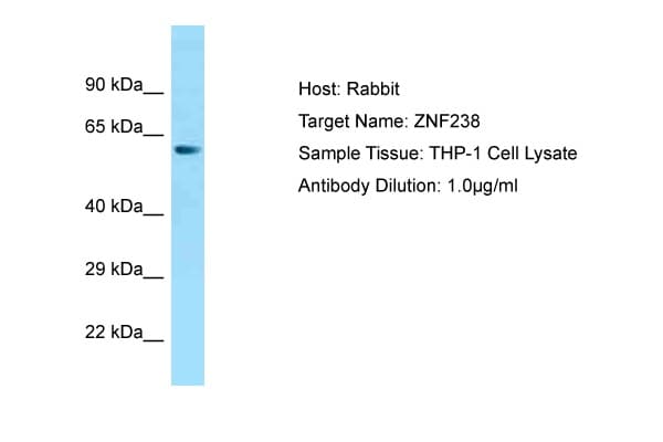 ZNF238 Antibody (aa143-192)
