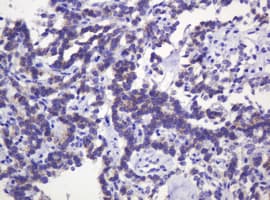 CTNND1 / p120 Catenin Antibody (clone OTI2E8)