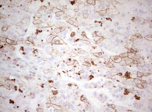 Basic Cytokeratin AE3 Antibody (clone AE3)