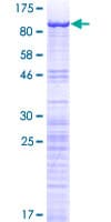 Human GNL3 / NS / Nucleostemin Protein (Recombinant GST)